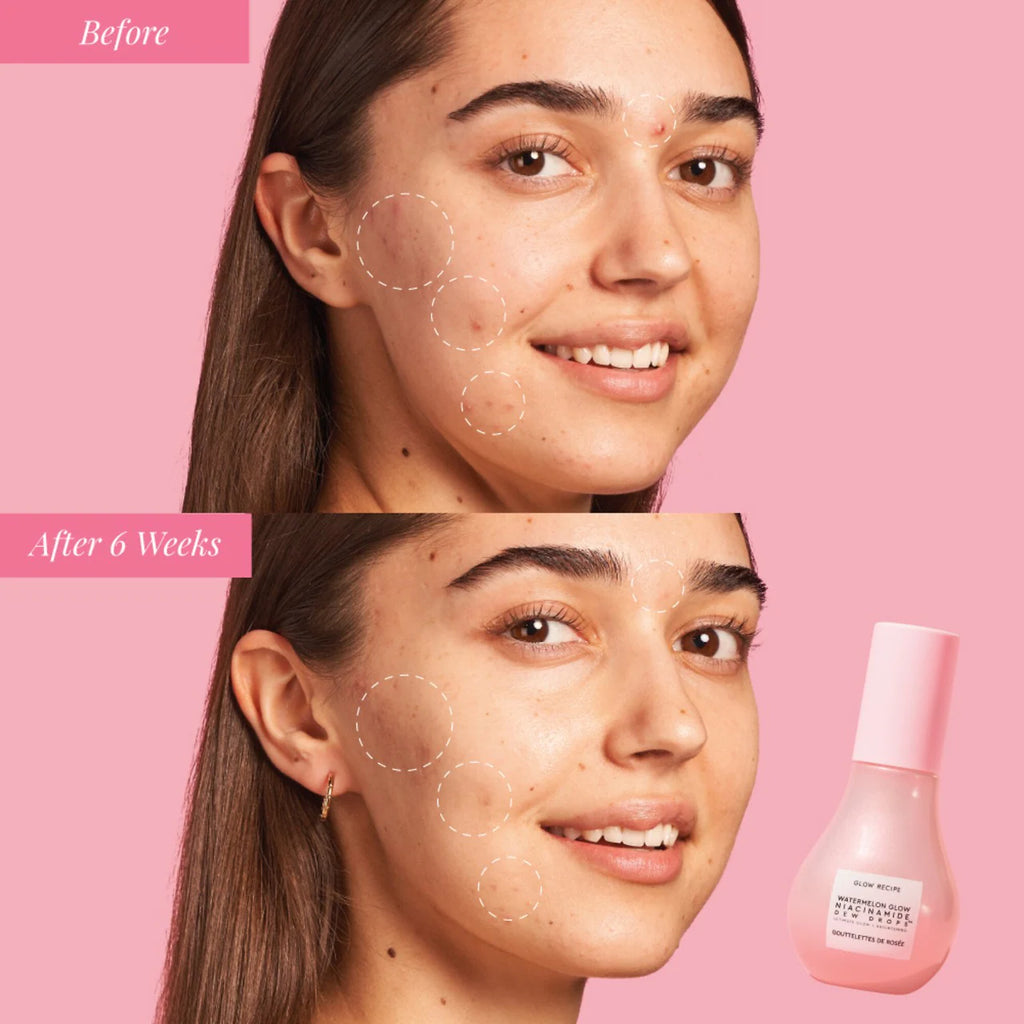 Glow Recipe  - Watermelon Glow Niacinamide Dew Drops Serum